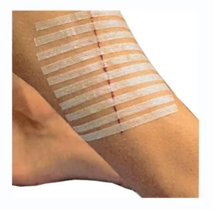 3 Pack 75mm Steri Strips Hypoallergenic Surgical Wound Reinforced Adhesive Skin Closures First Aid Sterile Wound Care