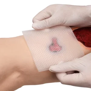 Adaptic Self-Adhesive Silicone Contact Layer Transparent Sterile Primary Wound Dressing 10x10cm ISO13485 Certified for