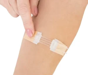 Adhesive Zip Stitch Sutures Butterfly Band Aids Sterile Laceration Closure Strips Bandages Without Stitches for Outdoors