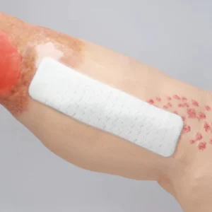 Alexer Silicone Post op Dressing with Border Flex Self Adhesive Wound Care and Dressings