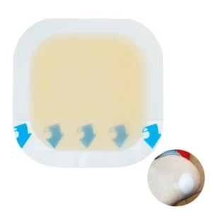 Anti-Allergic Medicinal Advanced Transparent Hydrocolloid Wound Dressing CE Certified Waterproof High Absorbency Class II