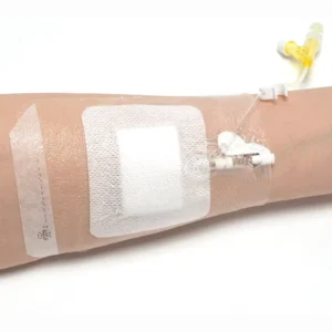 Antibacterial Transparent Wound Dressing Hypoallergenic Medical Grade PU Indwelling Needle Patch
