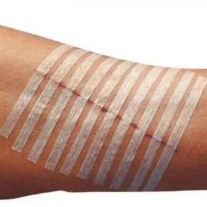 Breathable Steri Strip Wound Closure Dressing Reinforced Adhesive 100mm Size EO Sterilized Blister Packing CE Certified Class I