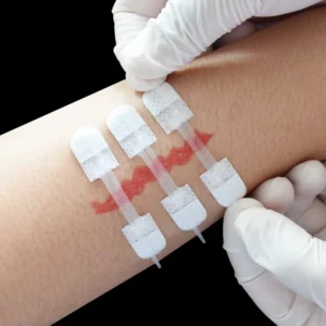 CE ISO Zip Reinforced Topical Skin Wound Steri Strip Tape Steri Adhesive Strips Surgical Wound Skin Closure Device
