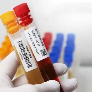 Customized Disposable Medical Vacuum Blood Collection Tube Labels Stickers for Surgical Collecting or Testing Blood