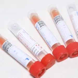 DNA Collection Disposable Sampling Tube Sterile Packaging Vtm Packing Tape Kit Medical Sterile Test Transport Tube with Swab