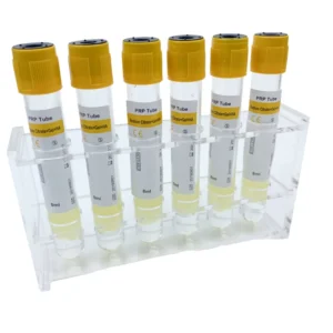 Disposable Glass Vacuum Blood Collection Tube High Duty Medical Grade 1-10ml Test Tube for Hospital/Laboratory Use