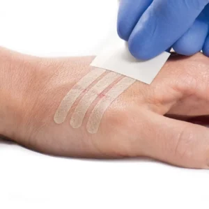 Disposable Sterilized Steri Strips for Wound Closure Surgical Skin Closure Products