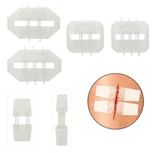 Emergency Laceration Medical Transparent Zip Stitch Dressing with Steri Wound Closure Device