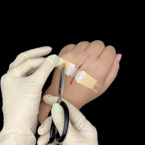Emergency Suture Free Steri Seamless Skin Closure Strip Tape Adhesive Wound Dressing Plaster Zip Stitch CE Certified Class II