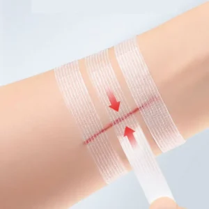 Emergency Wound Closures Surgical Quality Laceration Repair Stitches Steri Strips CE Certified Class I XINFA Brand 3 Year Shelf