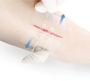 Extra Large Steri Strips Wound Closure Device Waterproof Butterfly Wound Closure Strips