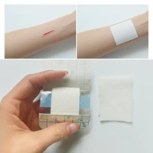 High Quality Chitosan Hemostatic Gauze Disposable Medical Wound Dressing Chitin Chitosan Wound Dressing