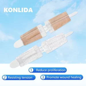 High Quality Hospital Surgical Sterile EO Disinfecting Class II Wound Closure Strips Steri Strip Tape for Skin Closure