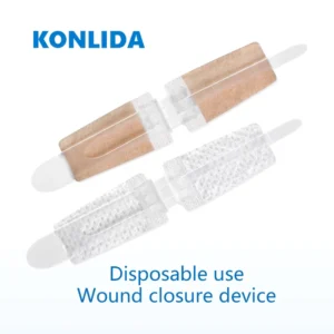 Hospital Surgical Sterile Wound Closure Strips Steri Strip Tape for Skin Closure