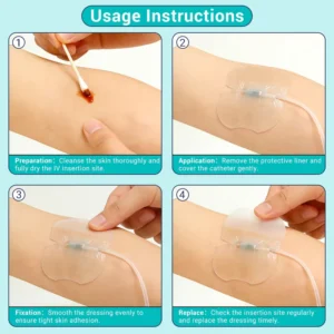 Hypo-allergenic Silicone IV Fixation Dressing Adhesive Silicone IV Catheter Adhesive Dressing Secure Fixation