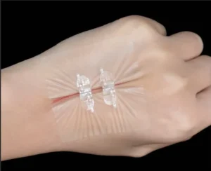 Individual Packing Steri Strips Non Woven Wound Closure Device for Less Scars Wound Skin