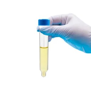 Lab Supplies 12ml Sterile Plastic Urine Sediment Tube with Blue Screw Cap Transparent Urinalysis Centrifuge Urine Test Tube