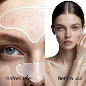Large Size Custom Shape Wound Dressing Pore Strips Pimple Master Stickers Waterproof Spot Hydrocolloid Acne Patch Vagan