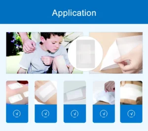 Latex free Waterproof Sterile Medical Non woven Adhesive Transparent Self adhesive Wound Dressing