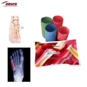 Lightweight High Toughness Polymer Fiberglass Bandage Medical Rehabilitation Support Tape