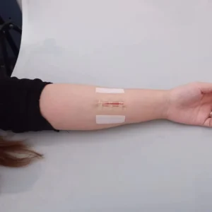 Medical Disposable Hydrocolloid Steri Strips Waterproof Sterile Skin Wound Care Closure Device