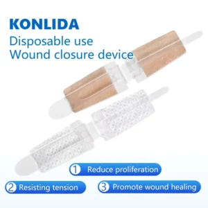 Medical Disposable Skin Wound Closure Device Zip Stitch Dressing