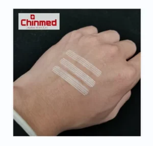 Medical Grade Adhesive Steri Strips Non Woven Wound Skin Closure for Wound Management
