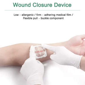 Medical PWT1003 CE Certified Class I Steri Strips Disposable Transparent PU Elastic Wound Closure Device