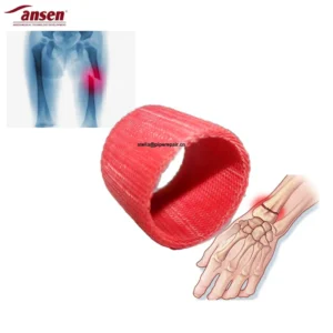 Medical Polymer Orthopedic Casting Bandage Quick Dry Sterile Fracture Immobilization Tape