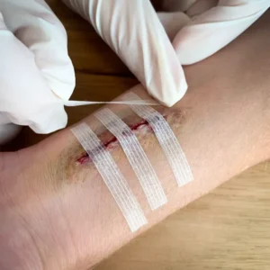 Medical Sterile Fabric Steri Strips Wound Skin Closure Reinforced Adhesive Skin Wound Closures