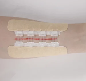 Medical Sterile Skin Color Wound Care Zipper First Aid Stitch Tape Wound Closure Device Category Steri Strips