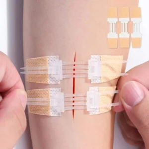 Medical Sterile Skin Tone White Wound Zipper Emergency Suture Strip Wound Closure Device Category Steri Strips