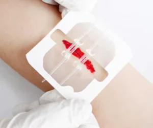 Medical Transparent Wound Closure Film Emergency Zip Stitch Dressing Device Steri Strips