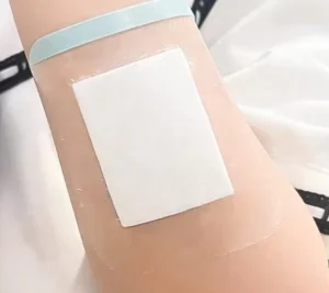 Medical Transparent Wound Dressing with Absorbent Pad Waterproof Sterile PU Film Hypoallergenic Long lasting Bond for Wound Care
