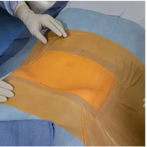 OEM Iodine Antimicrobial Waterproof Self-Adhesive Disposable Transparent Wound Dressing PU Incise Film