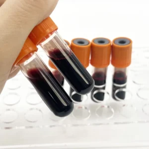 PET Hematology Vet 3 Part Veterinary Human Hematologic Blood Analysis Kit Rehabilitation Therapy Supplies