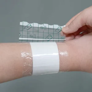 PU Adhesive Dressing Transparent Wound Closure Wound Plaster