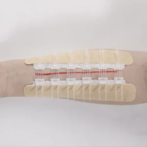 Portable Medical Disposable Steri Strips Non Woven Surgical Skin Closure Device for Wound Care