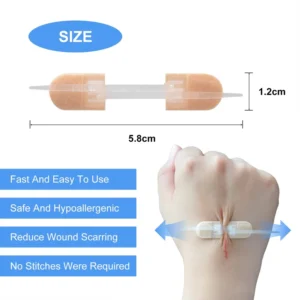 Portable Outdoor Steri Strips Zipper Tie Wound Closure Patch with Fast Suture Zipper Band Aid for Hemostasis