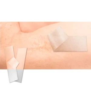 Professional Medical Silicone Scar Treatment Tape Reusable Waterproof Scar Sheet Breathable Soft Skin Patch for Surgical