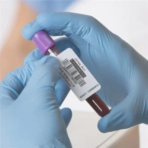 Self Adhesive Custom Pre Printed Glossy PP Waterproof Vinyl Serial Number Barcode QR Code Sticker Label for Blood Test Tube