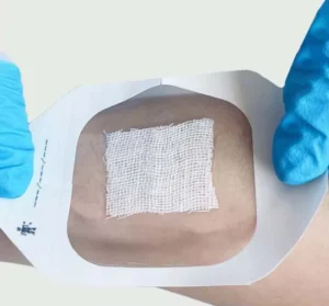 Self Adhesive Transparent Wound Dressing Medical Products Supplies for Hospitals Dressing for I.V. Cannula