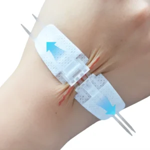 Self Adhesive Zip Sutures Wound Closure Device Non Woven Fabric Butterfly Bandages First Aid Wound Care Dressings
