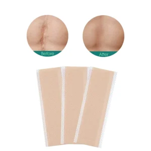 Silicone Gel Sheets for Scar Removal Reusable Silicone Scar Tape for Surgical Scars