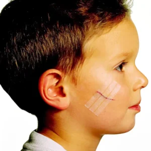 Skin Closure Strips Reinforcing Thread for Small Wounds Sutures Staples Medical Adhesive Suture Material CE