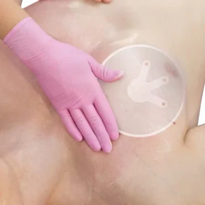 Sterile Adhesive Vented Chest Seal Wound Dressing First Aid Kit for Outdoor Survival for Breasts