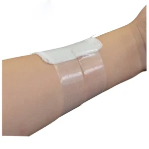Surgical Micropore Waterproof Transparent Surgical PE Medical Adhesive Tape