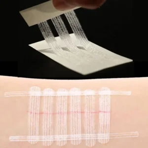 Suture Free Steri Strips Medical Surgical Adhesive Tape for Postpartum Postoperative Wound Closure Dressing for Wound Closure
