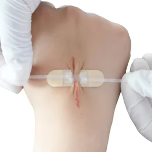 Sutures Band Aids for Wounds Repair Zipper Wound Closure Strip Sterile Skin Wound Closure Strip